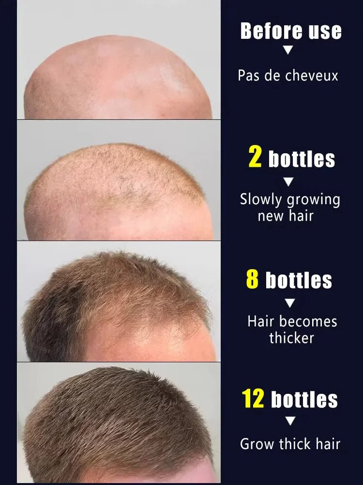 2 - in - 1 Hair Growth Scalp Applicator Brush – Massage & Oil Dispenser - Healora Shop