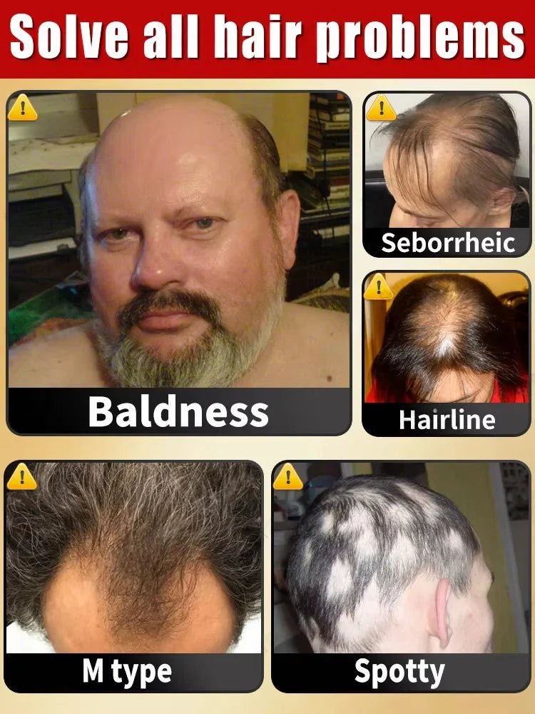 2 - in - 1 Hair Growth Scalp Applicator Brush – Massage & Oil Dispenser - Healora Shop