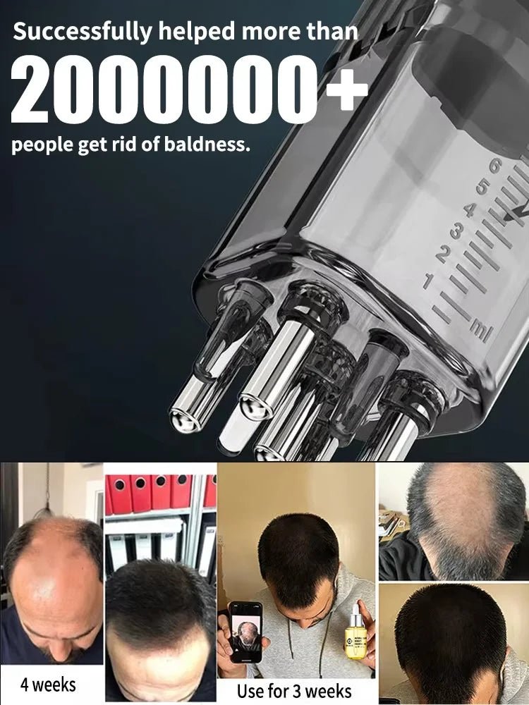 2 - in - 1 Hair Growth Scalp Applicator Brush – Massage & Oil Dispenser - Healora Shop